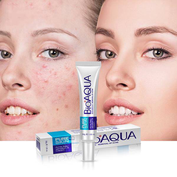 BIOAQUA 2 Pcs Anti Acne Removal Face Cream & Acne Removal Serum