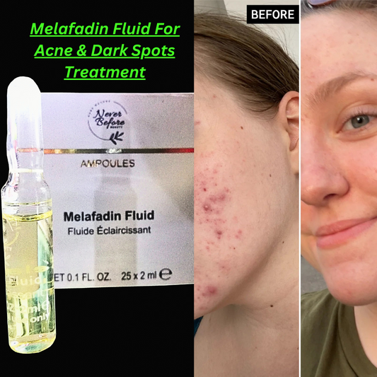 Never Before Melafadin Fluid Serum 2ml * 2