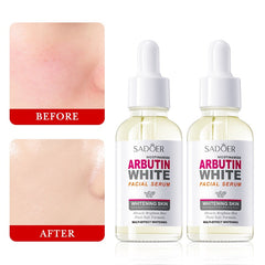 SADOER Arbutin Nicotinamide Brightening Face Serum 30ml