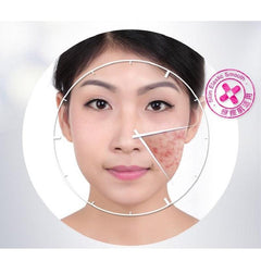 BIOAQUA Anti Acne Cream Acne Scar Removal Cream BQY0719