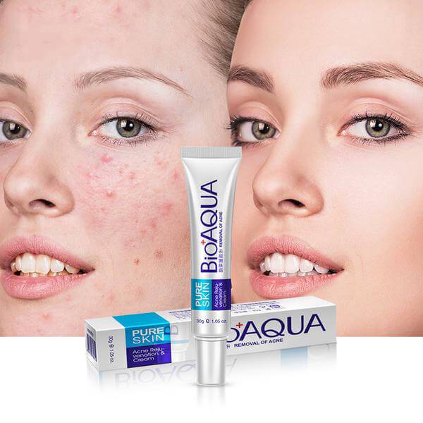 BIOAQUA Anti Acne Cream Acne Scar Removal Cream