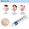 BIOAQUA Anti Acne Cream Acne Scar Removal Cream