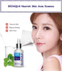 BIOAQUA 2 Pcs Anti Acne Removal Face Cream & Acne Removal Serum